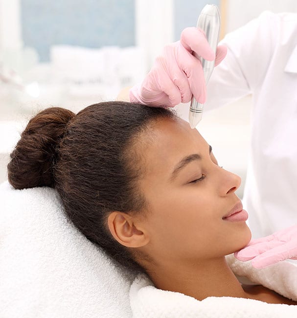 Microneedling Treatment